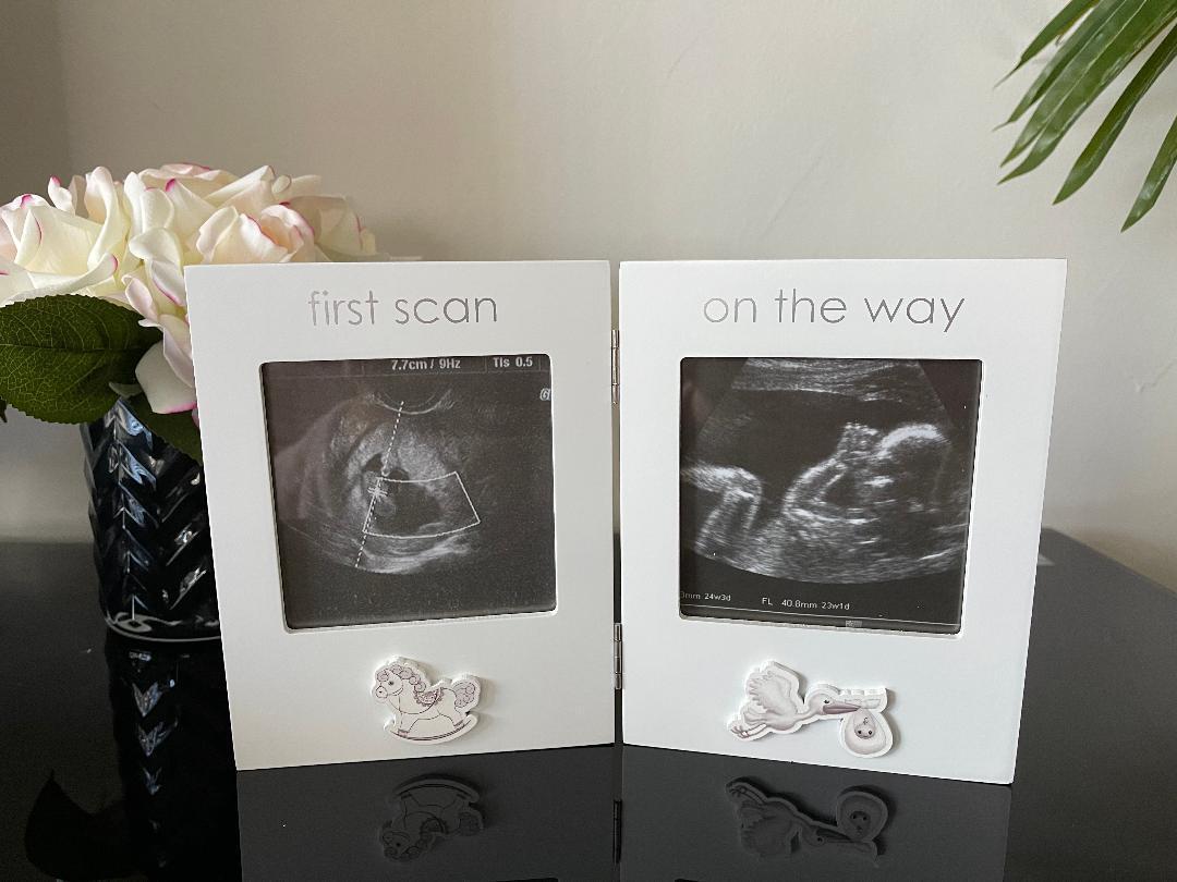 Baby First Photo Frame Ultrasound Picture Sonogram Baby Shower Newborn Gift